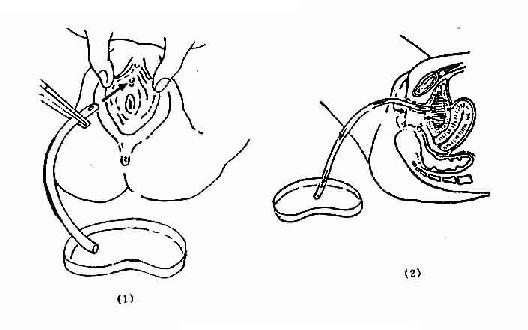 Ů�Ե�����