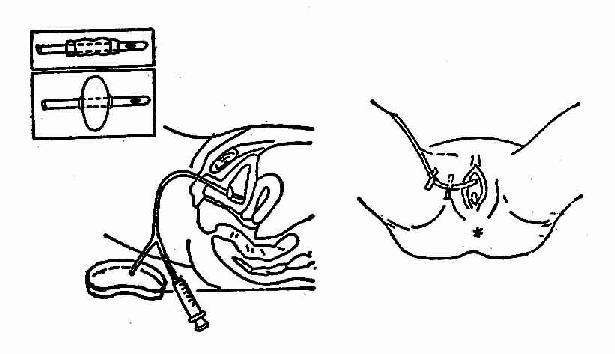 �����ҵ�������÷�