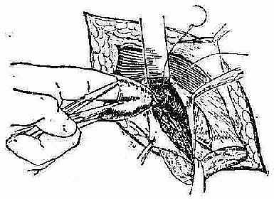 ���Ҿ�����λ�ᴩ����