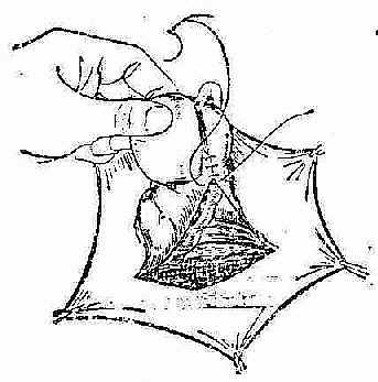 ����ä��