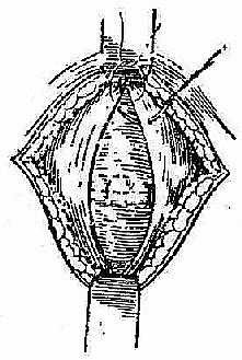 ��ϸ�ֱ���ʵı�Ե