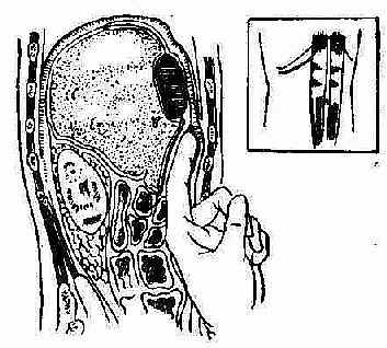 �Ҹ�ǰ�ϼ�϶ŧ�׵��п�������