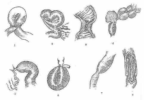 ��е�Գ�����ԭ��