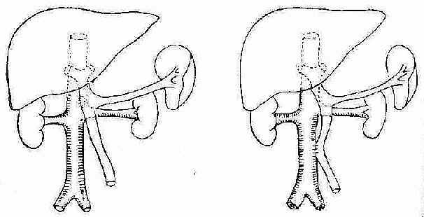 �ž�������