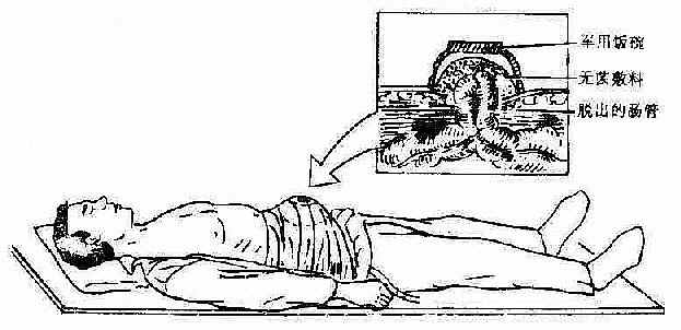 ���������˼��Ȱ�����