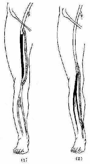 ������·��ֲ