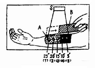 ��������ⶨ��