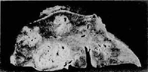 ϸ���Ը�ŧ��