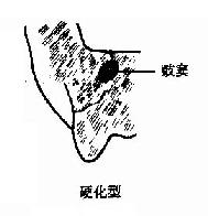 ��ͻ����