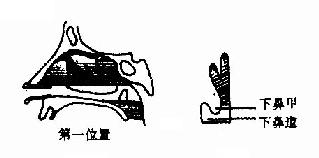 ǰ�Ǿ���������λ��