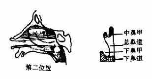 ǰ�Ǿ���������λ��