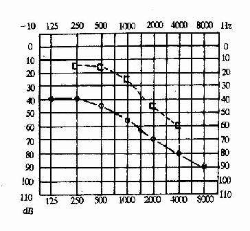 ����Զ������Ҷ���