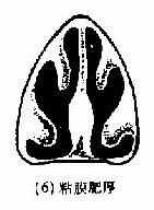 ���и�ƫ��������