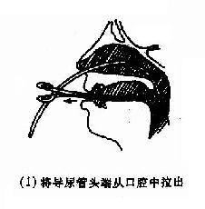 ��ǿ�������