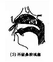 ��ǿ�������