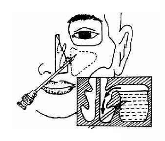 ���񼴩�̳�ϴ��