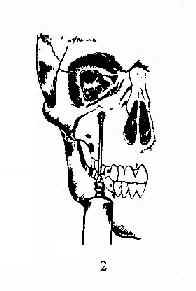 ��������� 2.��������������