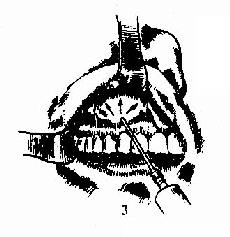 ��������� 3.������ճĤ�½�������