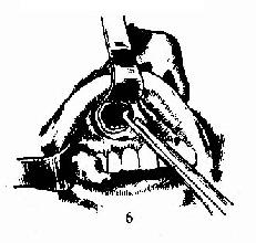 ��������� 6.����ǰ�ڶ��ڣ�����������֯