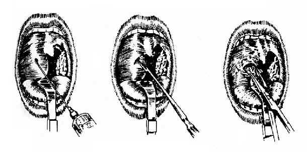 ��������Χŧ���п���ŧ