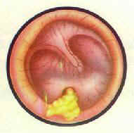 ���Ի�ŧ���ж� �׹�Ĥ����