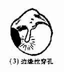 ��Ĥ��������