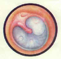 ��Ĥճ�����̺��γ�