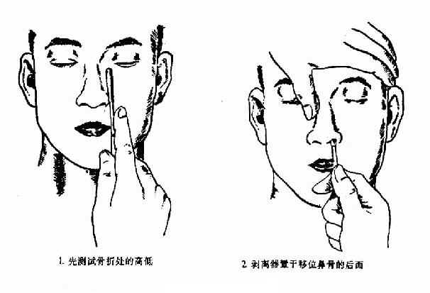 ��������λ��