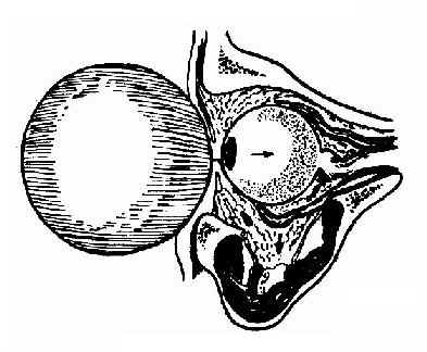 ���ױ���