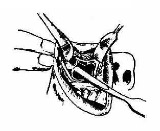 ȧ�ǹ��۾����񼸴λ��