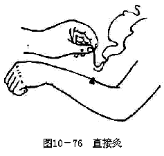 ���ľ�-ֱ�Ӿ�